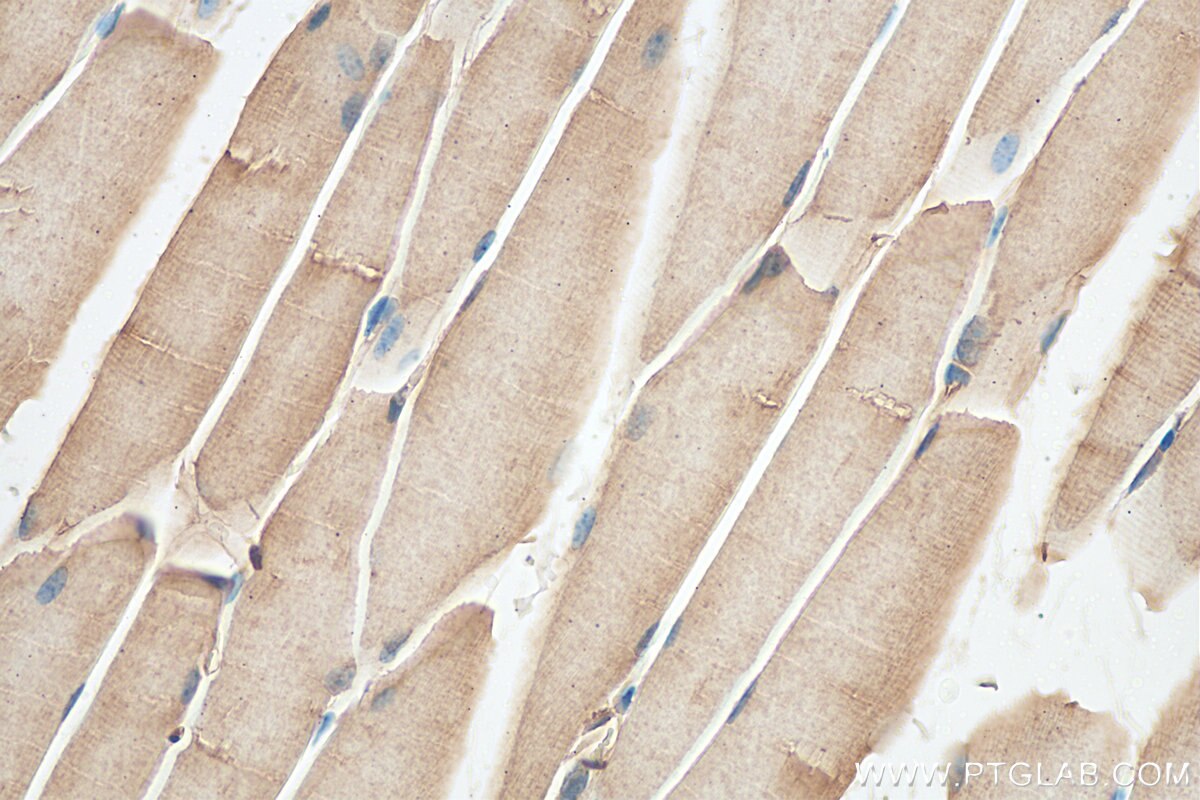 Immunohistochemistry (IHC) staining of mouse skeletal muscle tissue using SCO2 Polyclonal antibody (21223-1-AP)