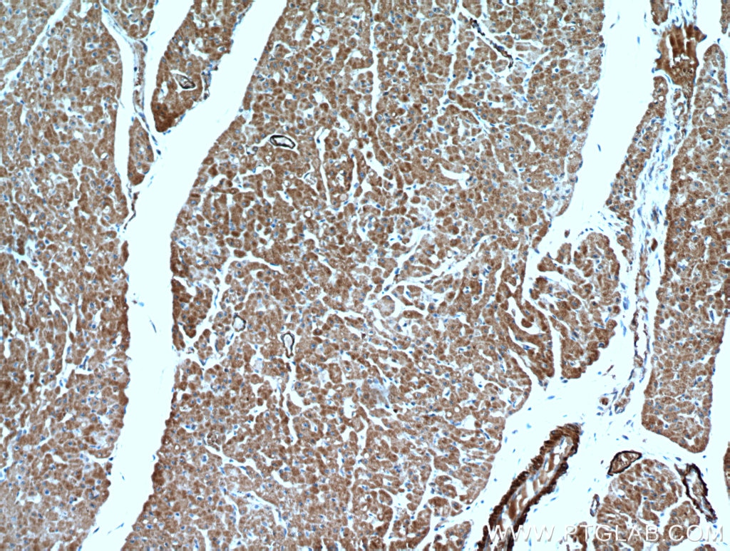 Immunohistochemistry (IHC) staining of human heart tissue using SCO2 Polyclonal antibody (21223-1-AP)