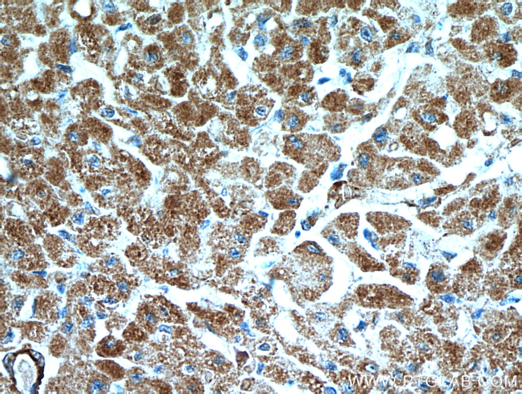 Immunohistochemistry (IHC) staining of human heart tissue using SCO2 Polyclonal antibody (21223-1-AP)