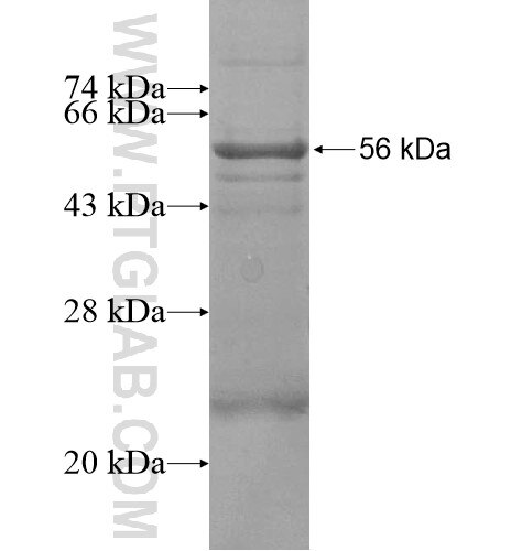 SCO2 fusion protein Ag15663 SDS-PAGE