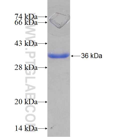 SCO2 fusion protein Ag15866 SDS-PAGE