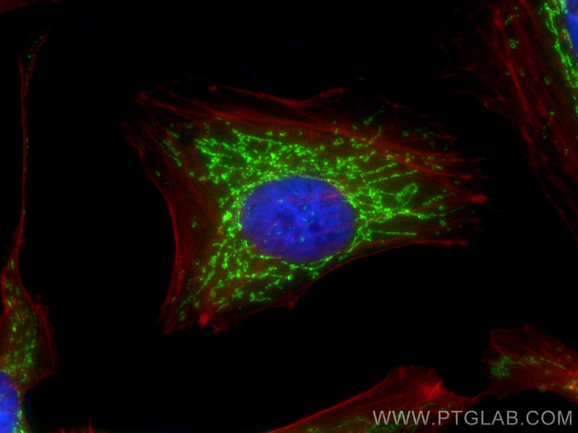 Immunofluorescence (IF) / fluorescent staining of HeLa cells using OXCT1 Polyclonal antibody (12175-1-AP)