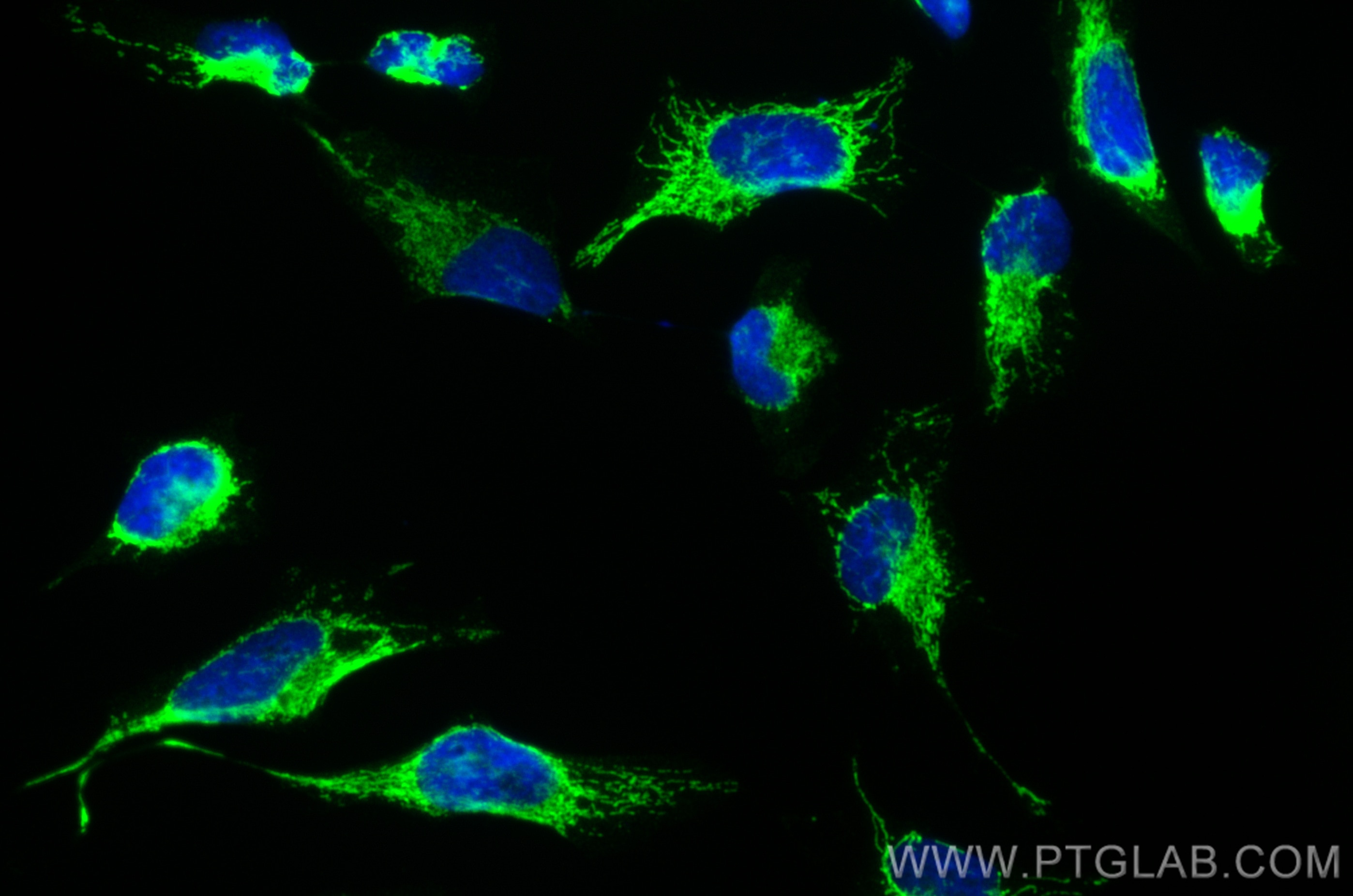 Immunofluorescence (IF) / fluorescent staining of HeLa cells using OXCT1 Polyclonal antibody (12175-1-AP)