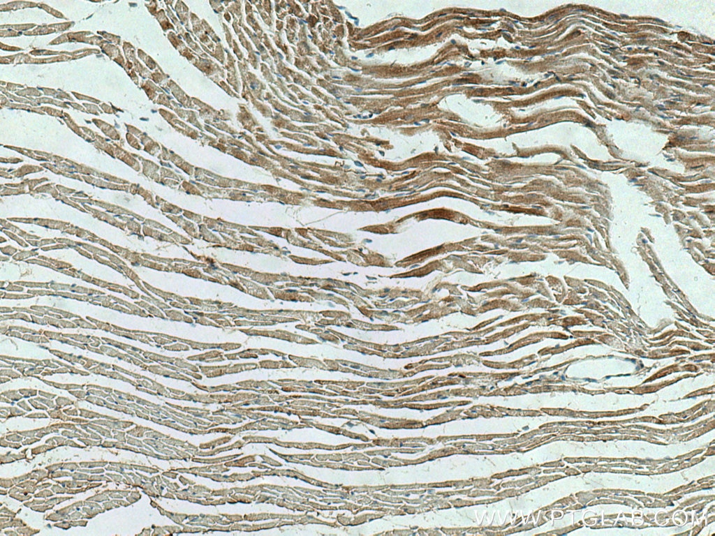 Immunohistochemistry (IHC) staining of mouse heart tissue using OXCT1 Polyclonal antibody (12175-1-AP)