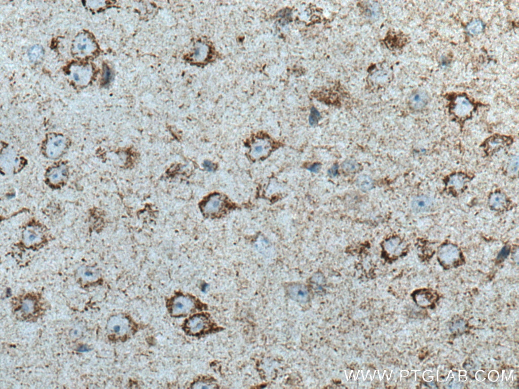 Immunohistochemistry (IHC) staining of mouse brain tissue using OXCT1 Polyclonal antibody (12175-1-AP)