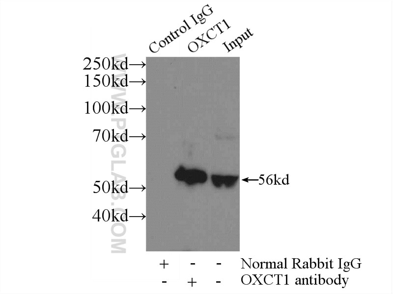 Immunoprecipitation (IP) experiment of mouse brain tissue using OXCT1 Polyclonal antibody (12175-1-AP)