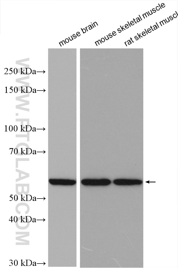 Western Blot (WB) analysis of various lysates using OXCT1 Polyclonal antibody (12175-1-AP)