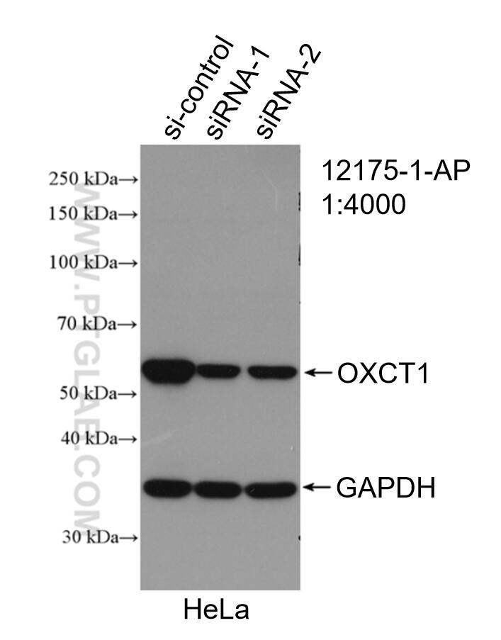 Western Blot (WB) analysis of HeLa cells using OXCT1 Polyclonal antibody (12175-1-AP)