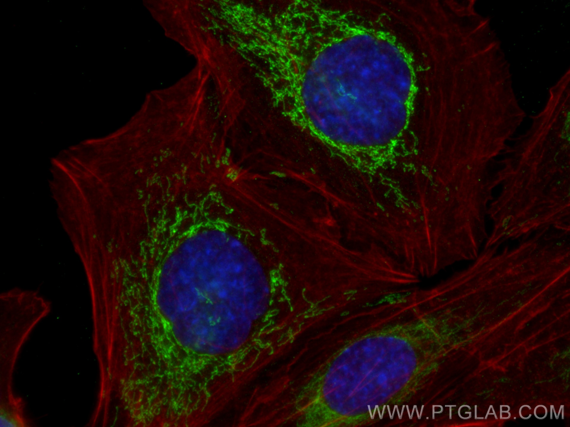 Immunofluorescence (IF) / fluorescent staining of SKOV-3 cells using OXCT1 Recombinant antibody (81011-1-RR)