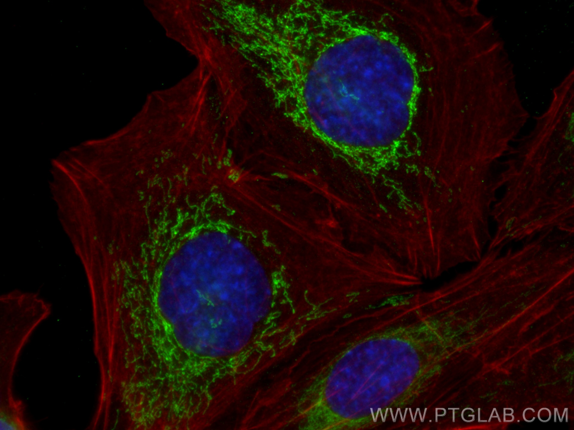 IF Staining of SKOV-3 using 81011-1-RR