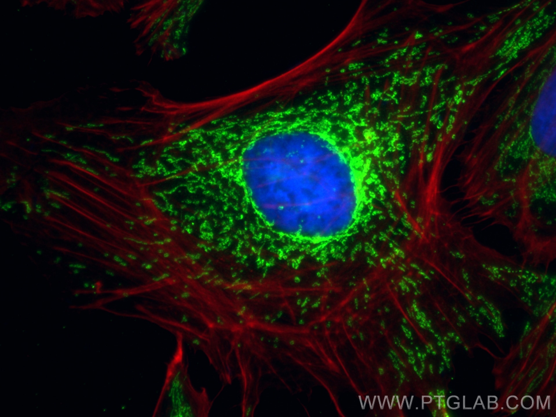 Immunofluorescence (IF) / fluorescent staining of HeLa cells using OXCT1 Recombinant antibody (81011-1-RR)