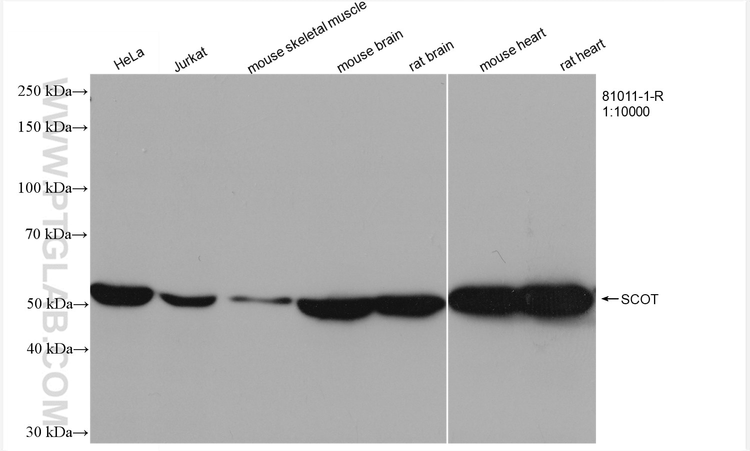 Western Blot (WB) analysis of various lysates using OXCT1 Recombinant antibody (81011-1-RR)