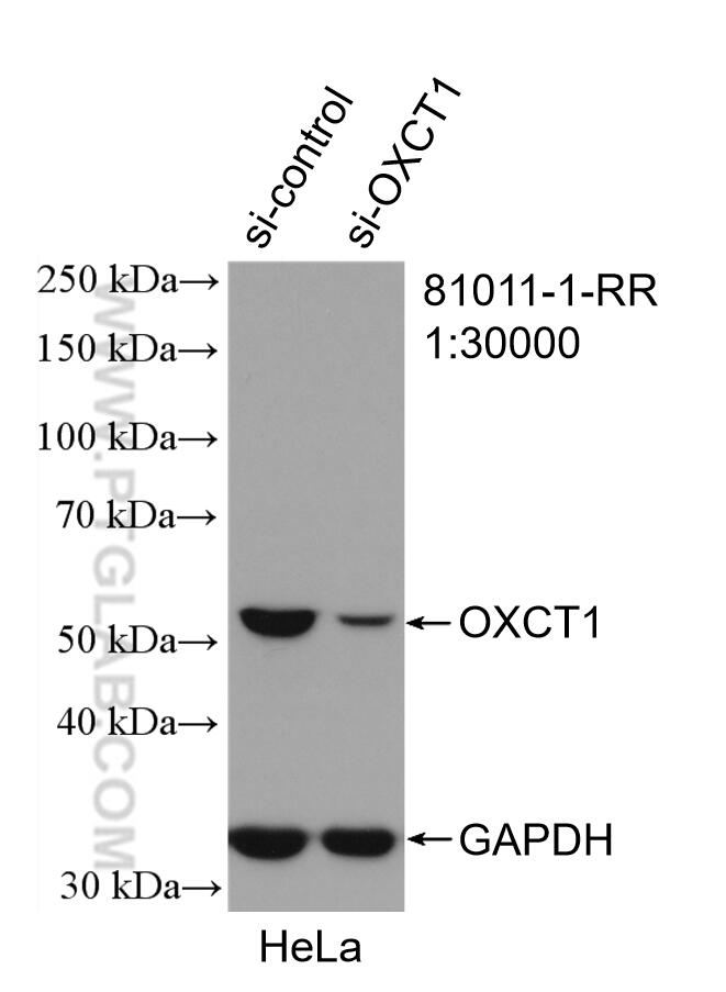 Western Blot (WB) analysis of HeLa cells using OXCT1 Recombinant antibody (81011-1-RR)