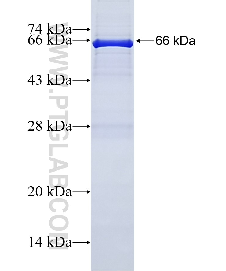 SCOT fusion protein Ag2818 SDS-PAGE