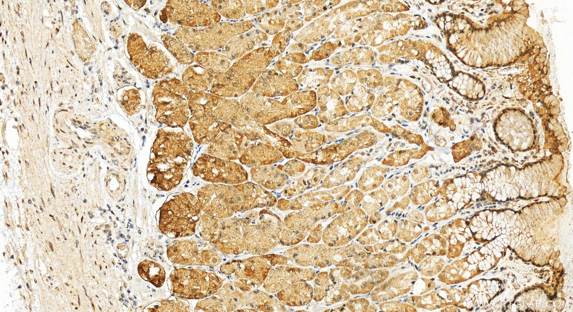 Immunohistochemistry (IHC) staining of human stomach tissue using SCP2/SCPx Polyclonal antibody (14397-1-AP)