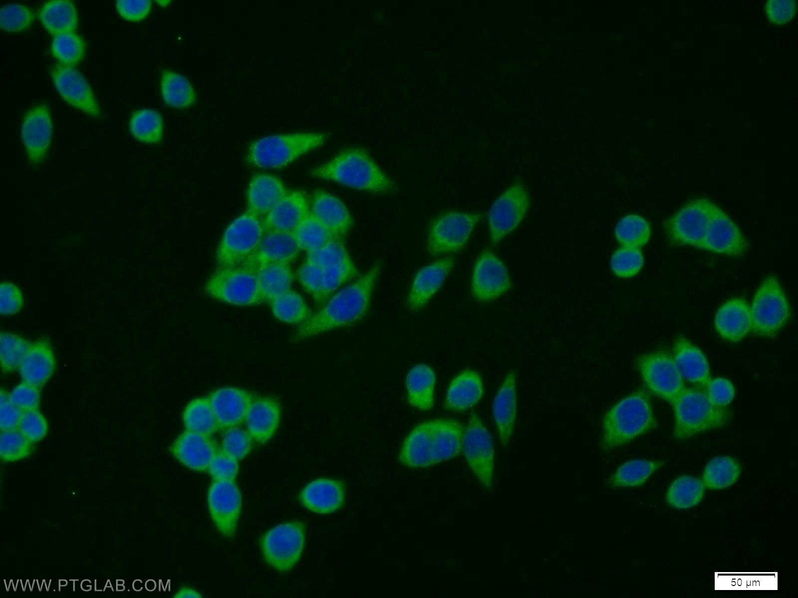 Immunofluorescence (IF) / fluorescent staining of BxPC-3 cells using SCP2/SCPx Polyclonal antibody (14397-1-AP)