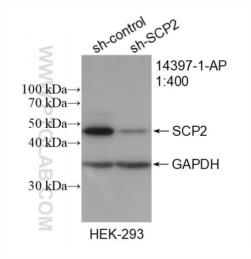 Western Blot (WB) analysis of HEK-293 cells using SCP2/SCPx Polyclonal antibody (14397-1-AP)