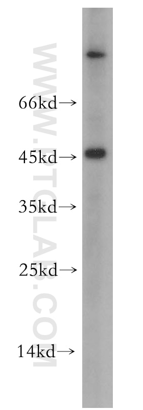 Western Blot (WB) analysis of A2780 cells using SCP2/SCPx Polyclonal antibody (19182-1-AP)