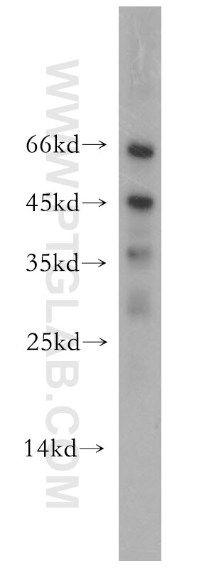 Western Blot (WB) analysis of mouse liver tissue using SCP2/SCPx Polyclonal antibody (19182-1-AP)