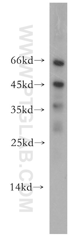 WB analysis of mouse liver using 19182-1-AP