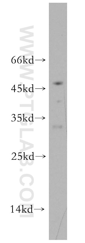 WB analysis of mouse ovary using 19182-1-AP