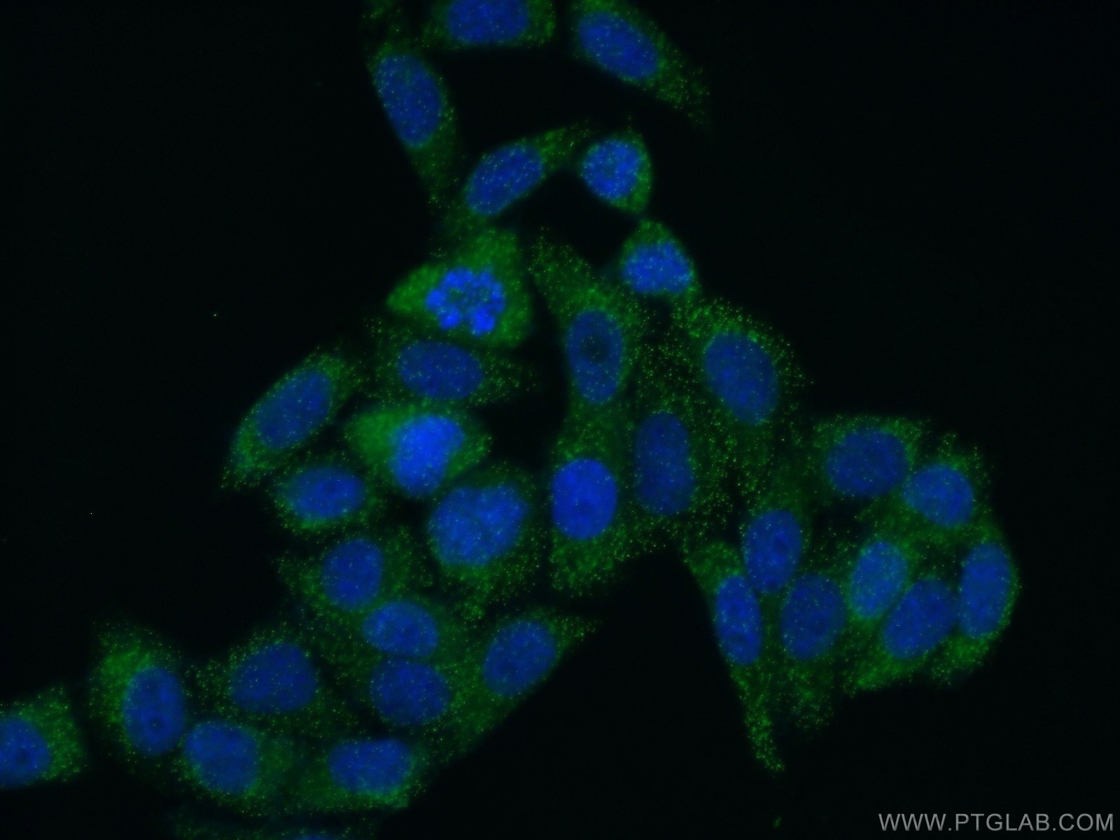 Immunofluorescence (IF) / fluorescent staining of HepG2 cells using SCP2 Polyclonal antibody (23006-1-AP)
