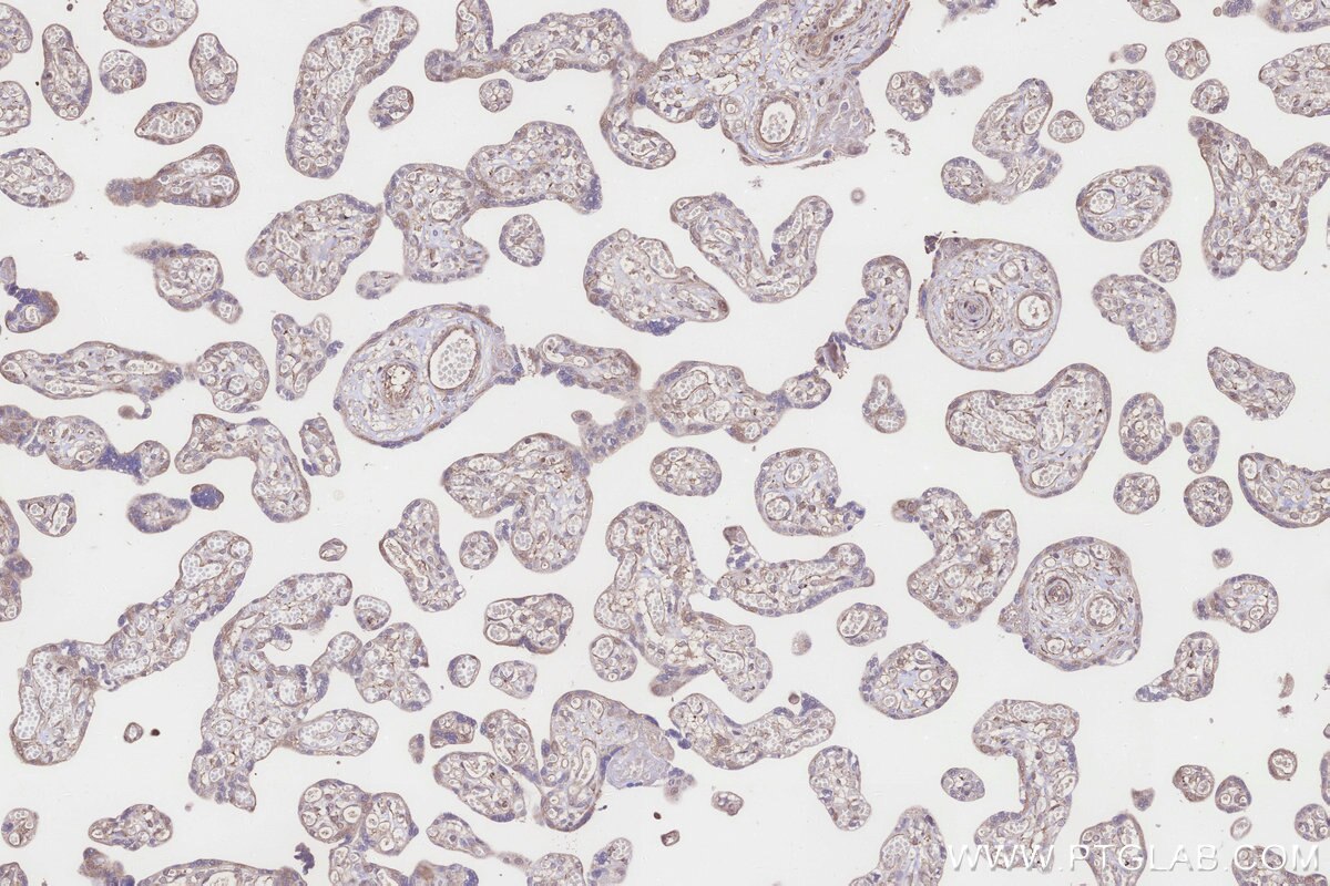 Immunohistochemistry (IHC) staining of human placenta tissue using SCP2/SCPx Polyclonal antibody (23006-1-AP)