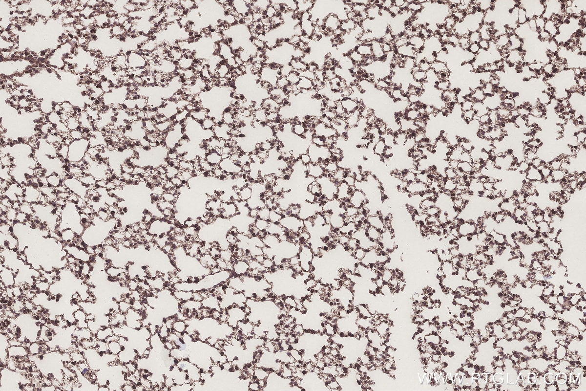 Immunohistochemistry (IHC) staining of mouse lung tissue using SCP2/SCPx Polyclonal antibody (23006-1-AP)
