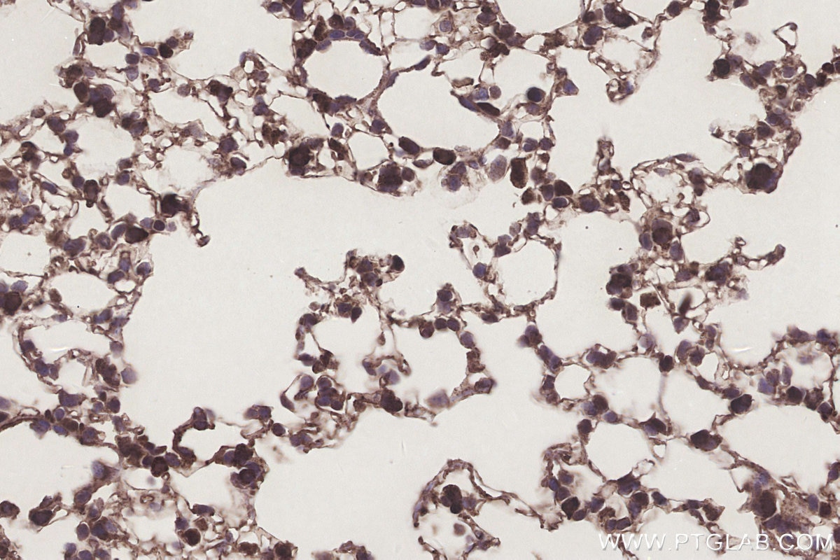 Immunohistochemistry (IHC) staining of mouse lung tissue using SCP2/SCPx Polyclonal antibody (23006-1-AP)