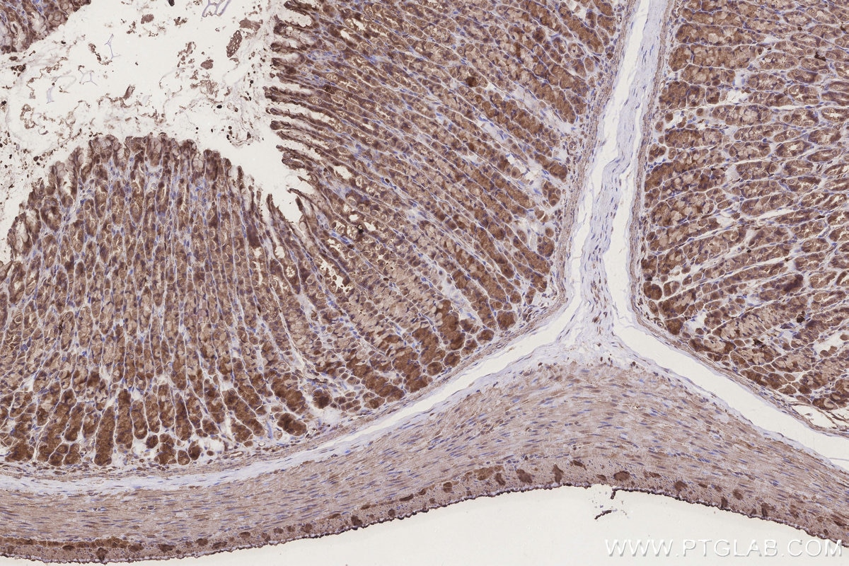 Immunohistochemistry (IHC) staining of rat stomach tissue using SCP2/SCPx Polyclonal antibody (23006-1-AP)