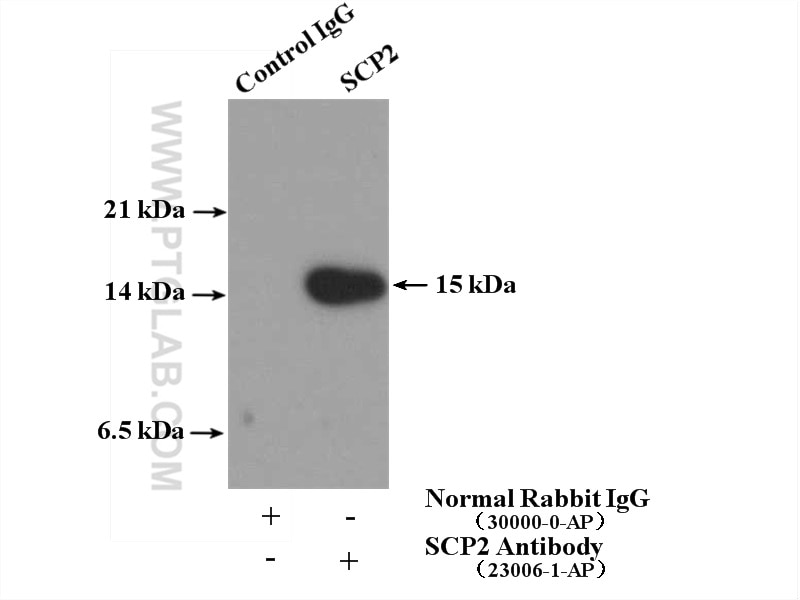 Immunoprecipitation (IP) experiment of HepG2 cells using SCP2 Polyclonal antibody (23006-1-AP)