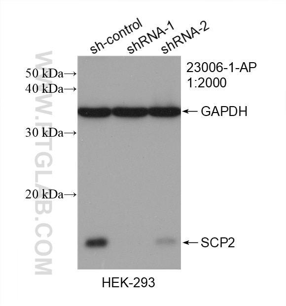 Western Blot (WB) analysis of HEK-293 cells using SCP2 Polyclonal antibody (23006-1-AP)