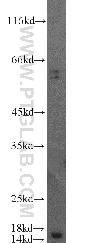 Western Blot (WB) analysis of K-562 cells using SCP2 Polyclonal antibody (23006-1-AP)