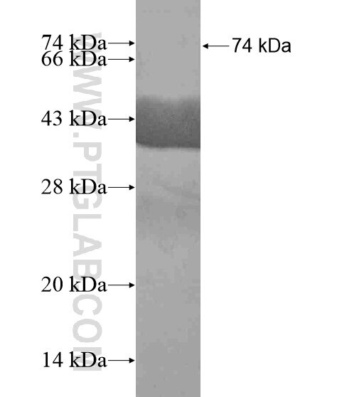 SCP2 fusion protein Ag19215 SDS-PAGE