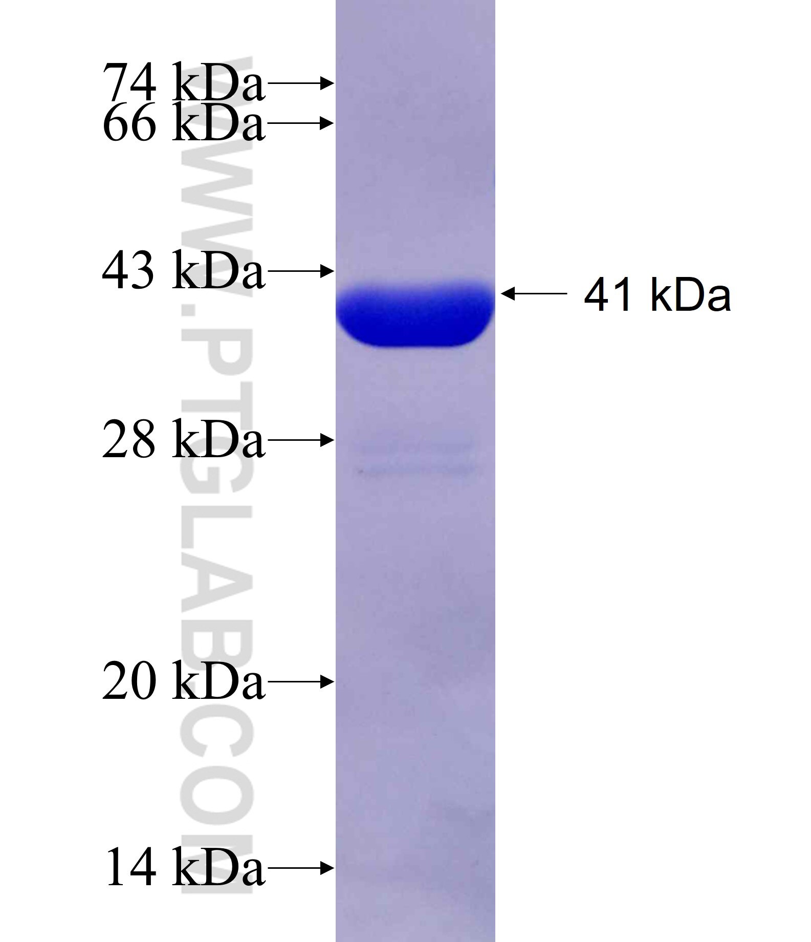 SCP2 fusion protein Ag19215 SDS-PAGE