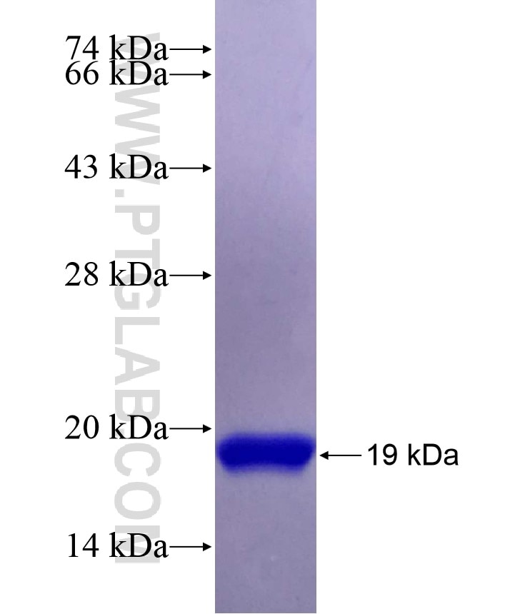 SCP2 fusion protein Ag19261 SDS-PAGE