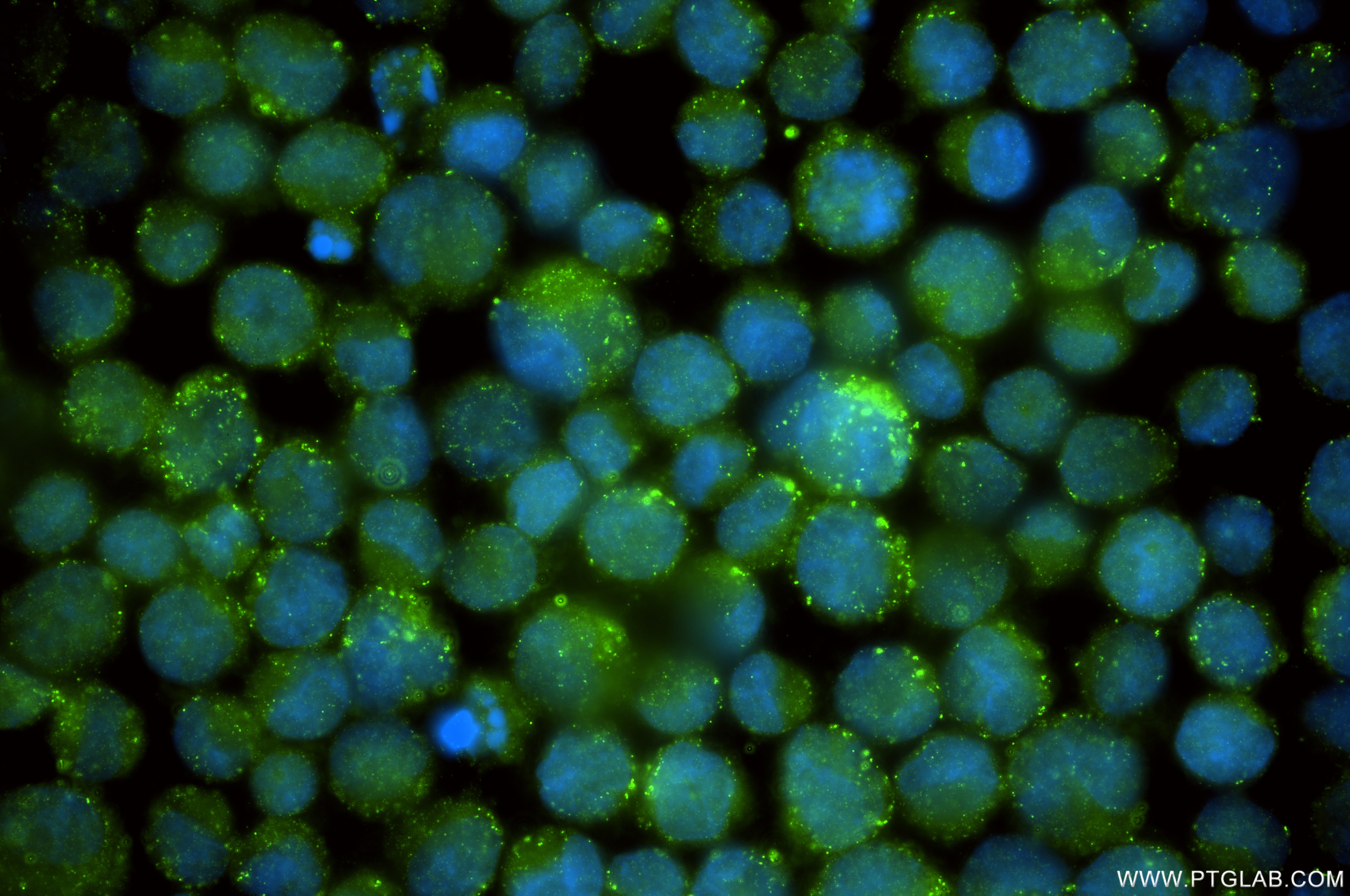Immunofluorescence (IF) / fluorescent staining of k562 using SCP2/SCPx Recombinant antibody (86196-3-RR)