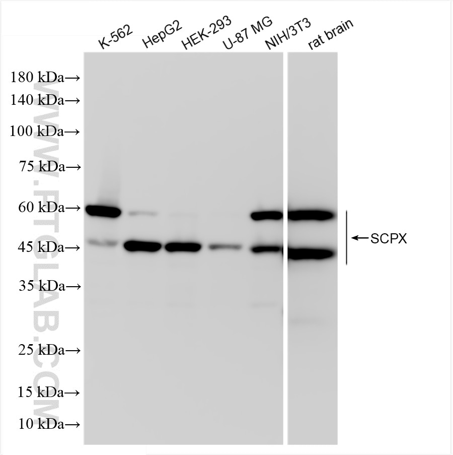 Western Blot (WB) analysis of various lysates using SCP2/SCPx Recombinant antibody (86196-3-RR)