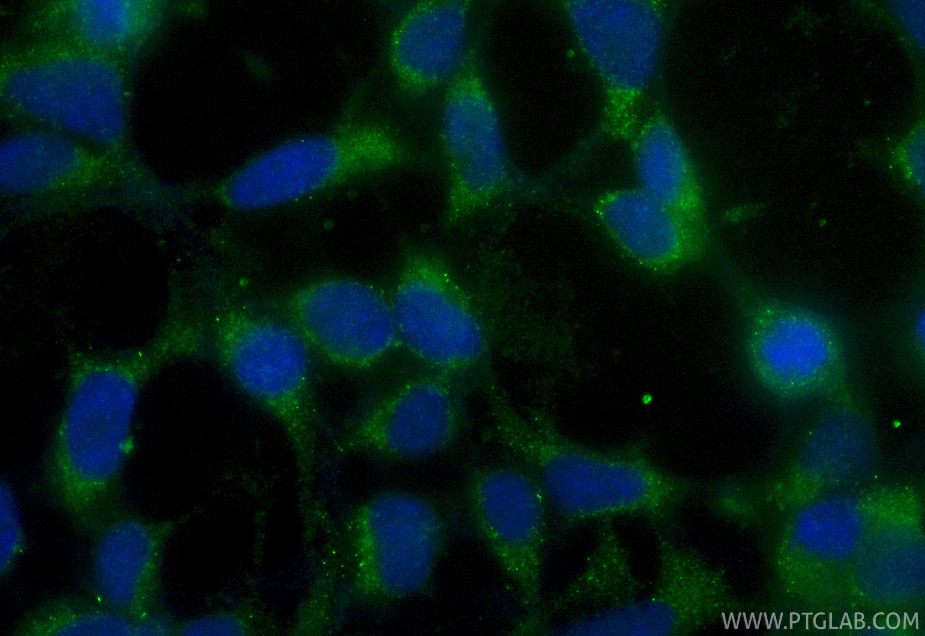 Immunofluorescence (IF) / fluorescent staining of HEK-293 cells using CoraLite® Plus 488-conjugated SCP2/SCPx Recombinan (CL488-86196-3)