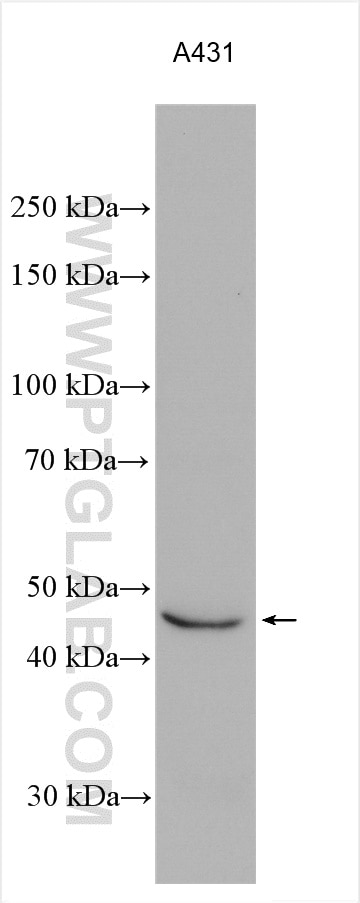 WB analysis using 29781-1-AP