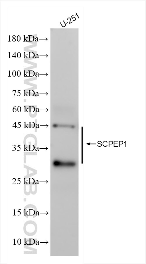 Western Blot (WB) analysis of U-251 cells using SCPEP1 Recombinant antibody (83786-4-RR)