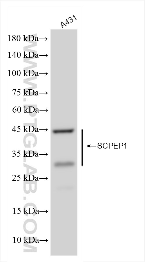 Western Blot (WB) analysis of A431 cells using SCPEP1 Recombinant antibody (83786-4-RR)