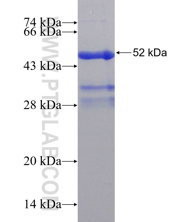 SCPEP1 fusion protein Ag31381 SDS-PAGE