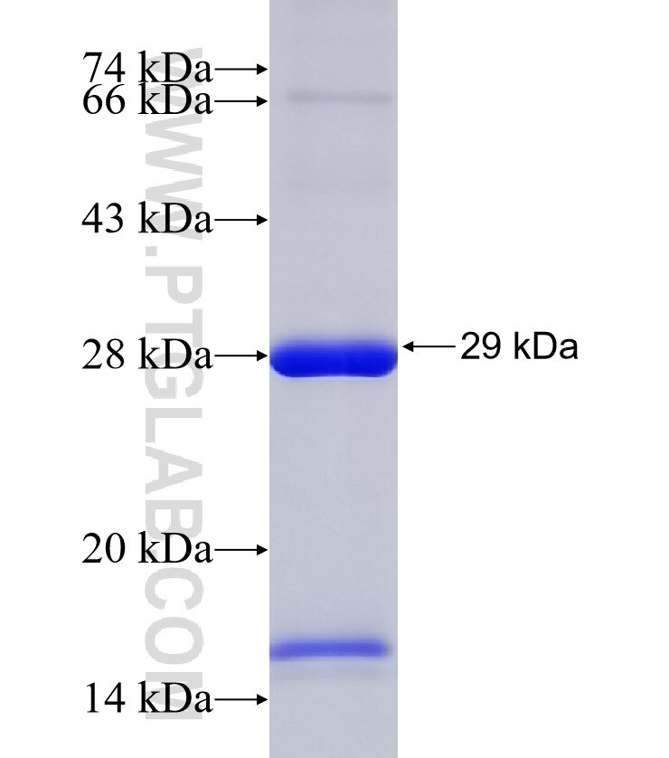 SCPEP1 fusion protein Ag31396 SDS-PAGE