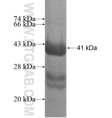 SCPEP1 fusion protein Ag11931 SDS-PAGE