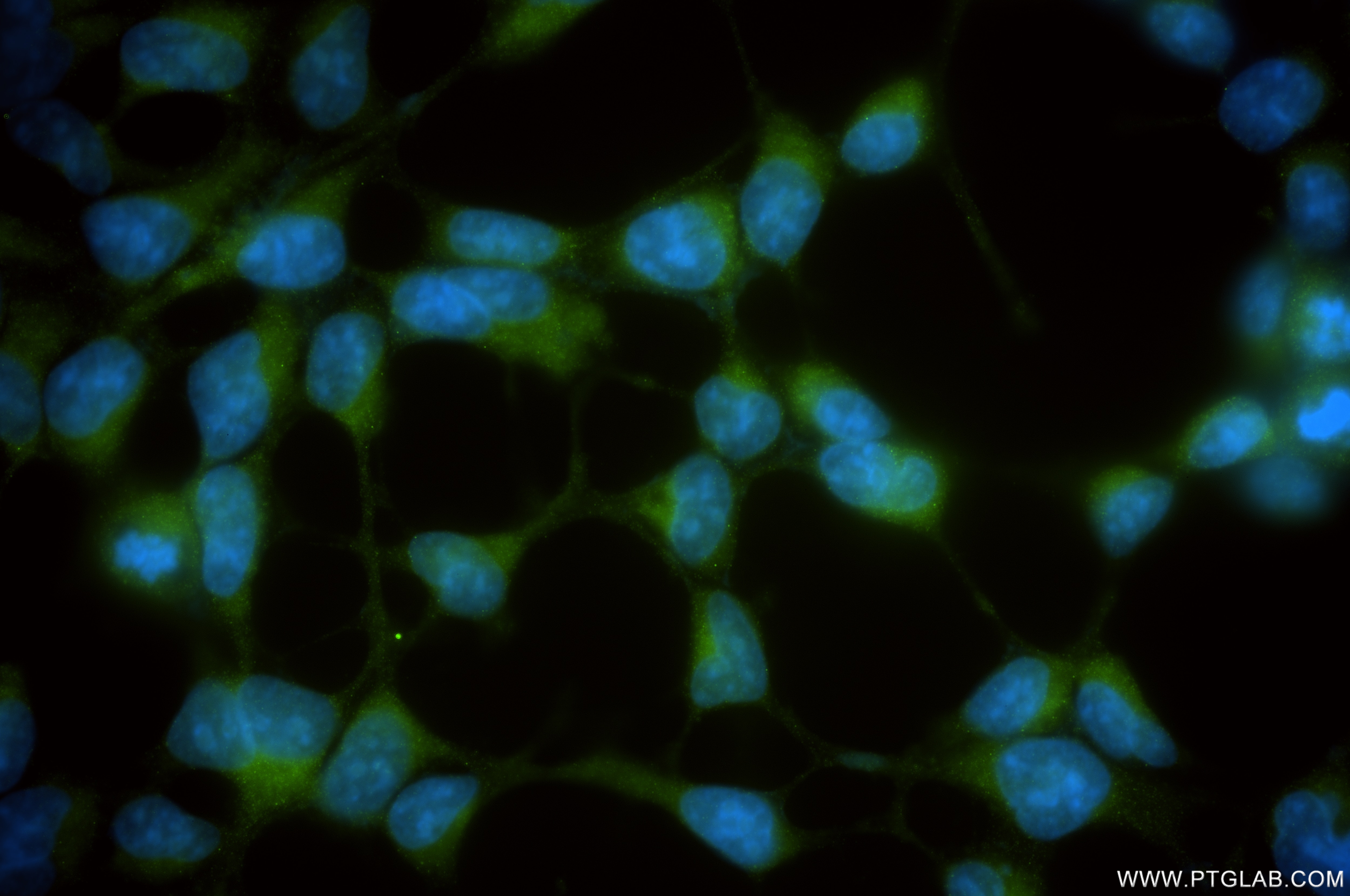 Immunofluorescence (IF) / fluorescent staining of HEK-293 cells using SCPX Recombinant antibody (86196-1-RR)