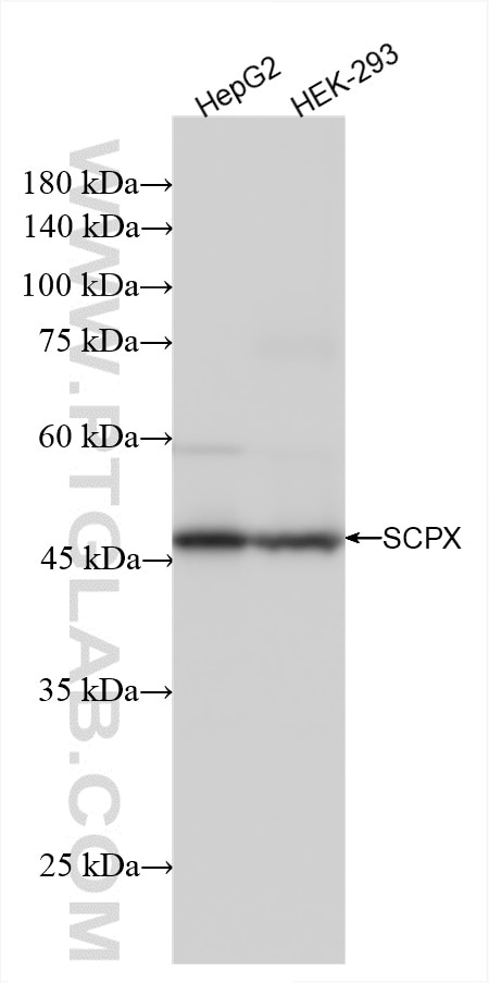 Western Blot (WB) analysis of various lysates using SCPX Recombinant antibody (86196-1-RR)
