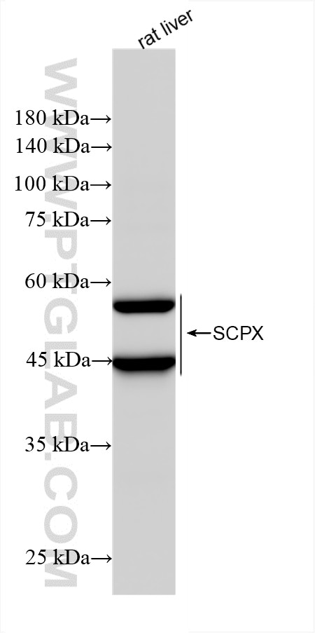 Western Blot (WB) analysis of rat liver tissue using SCPX Recombinant antibody (86196-1-RR)