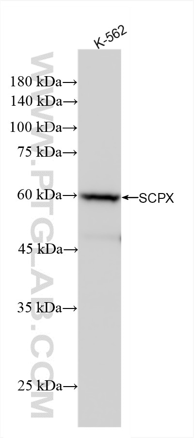 Western Blot (WB) analysis of K-562 cells using SCPX Recombinant antibody (86196-1-RR)