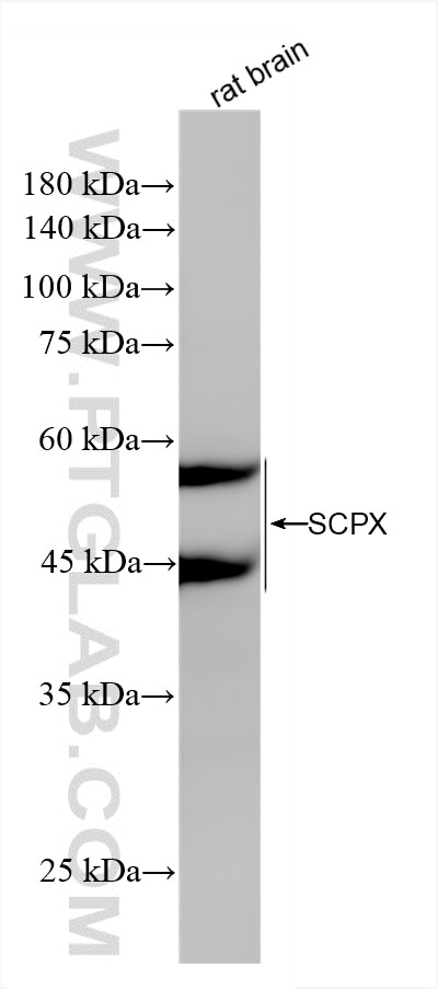 Western Blot (WB) analysis of rat brain tissue using SCPX Recombinant antibody (86196-1-RR)